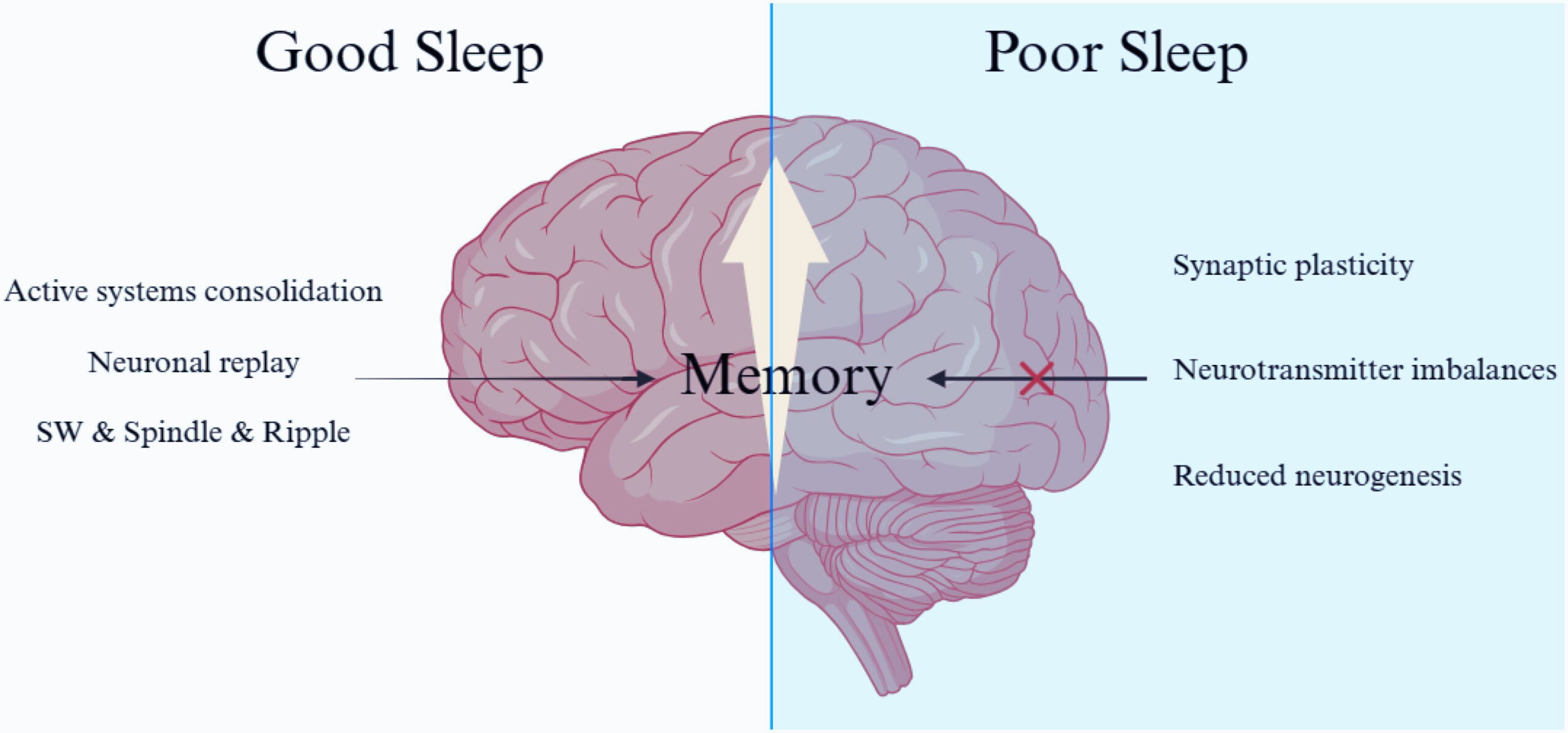 sleep and mental health